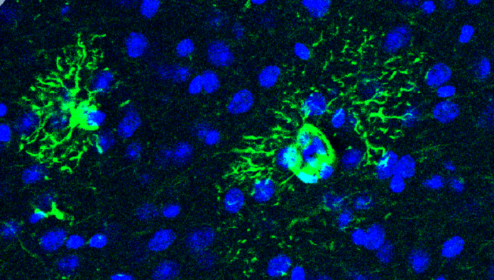 Descubren cómo una proteína induce cambios tempranos en el cerebro que anticipan el alzhéimer