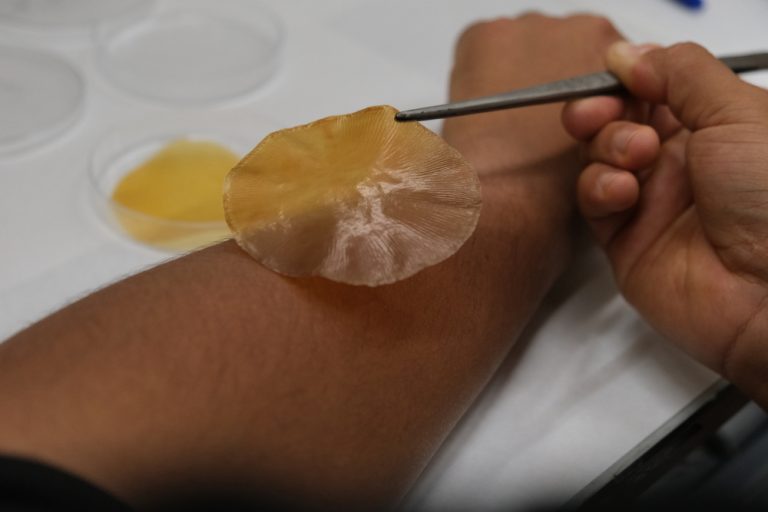 Crean apósitos que se activan con la luz solar para frenar infecciones bacterianas sin necesidad de antibióticos