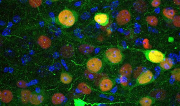 Identifican un grupo de neuronas implicado en la regulación de la ansiedad y los trastornos sociales