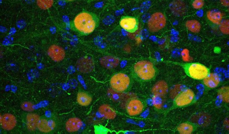Identifican un grupo de neuronas implicado en la regulación de la ansiedad y los trastornos sociales