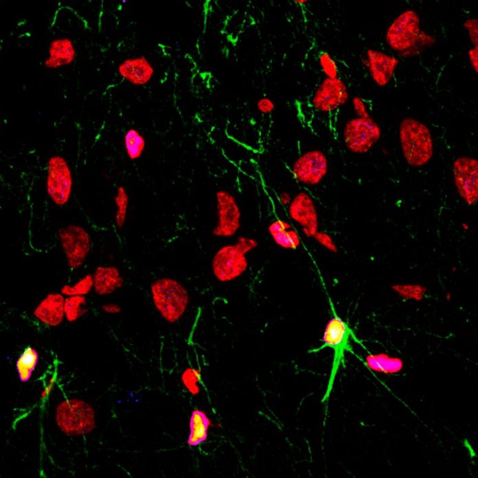 Un estudio del CSIC demuestra que las enfermedades psiquiátricas y el consumo de alcohol y drogas limitan la capacidad del cerebro para generar nuevas neuronas
