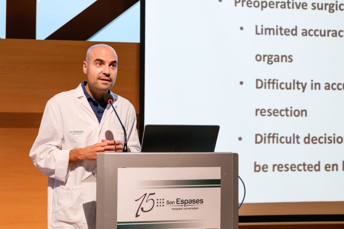 Son Espases mejora la supervivencia del cáncer colorrectal avanzado con una tecnología quirúrgica 3D pionera en España